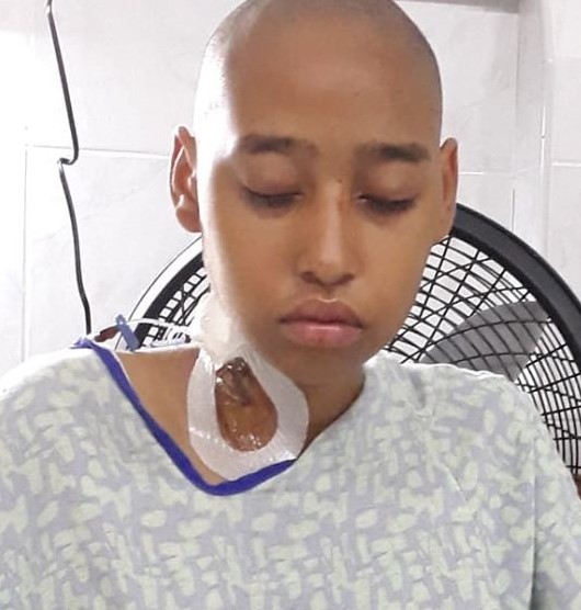 Harmony Young undergoes brain surgery - Belize News and Opinion on  