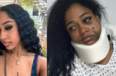 Belizean mother needs urgent surgery after Placencia shooting